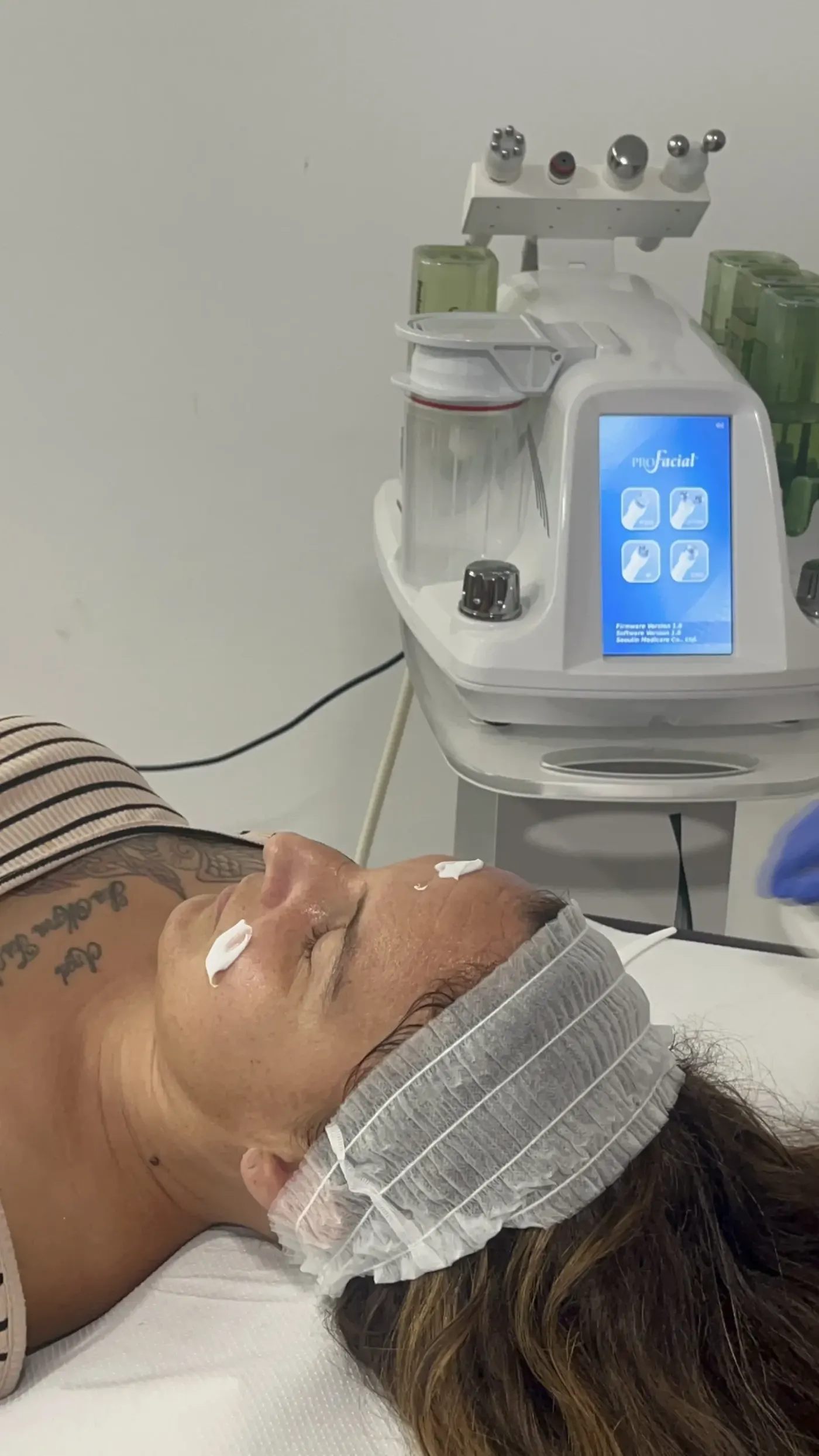Tratamiento facial con aparatología de medicina estética en Alicante