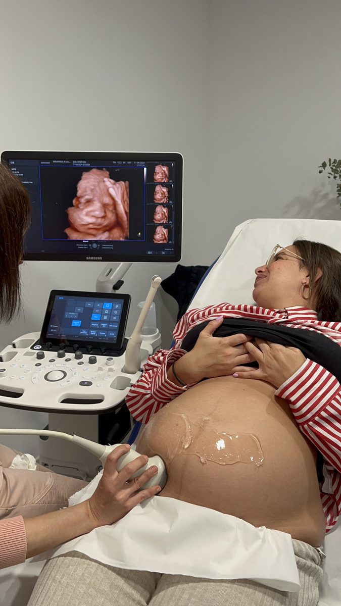 Ecografía de embarazo en la consulta de ginecología de Mimando a Mamá, Alicante