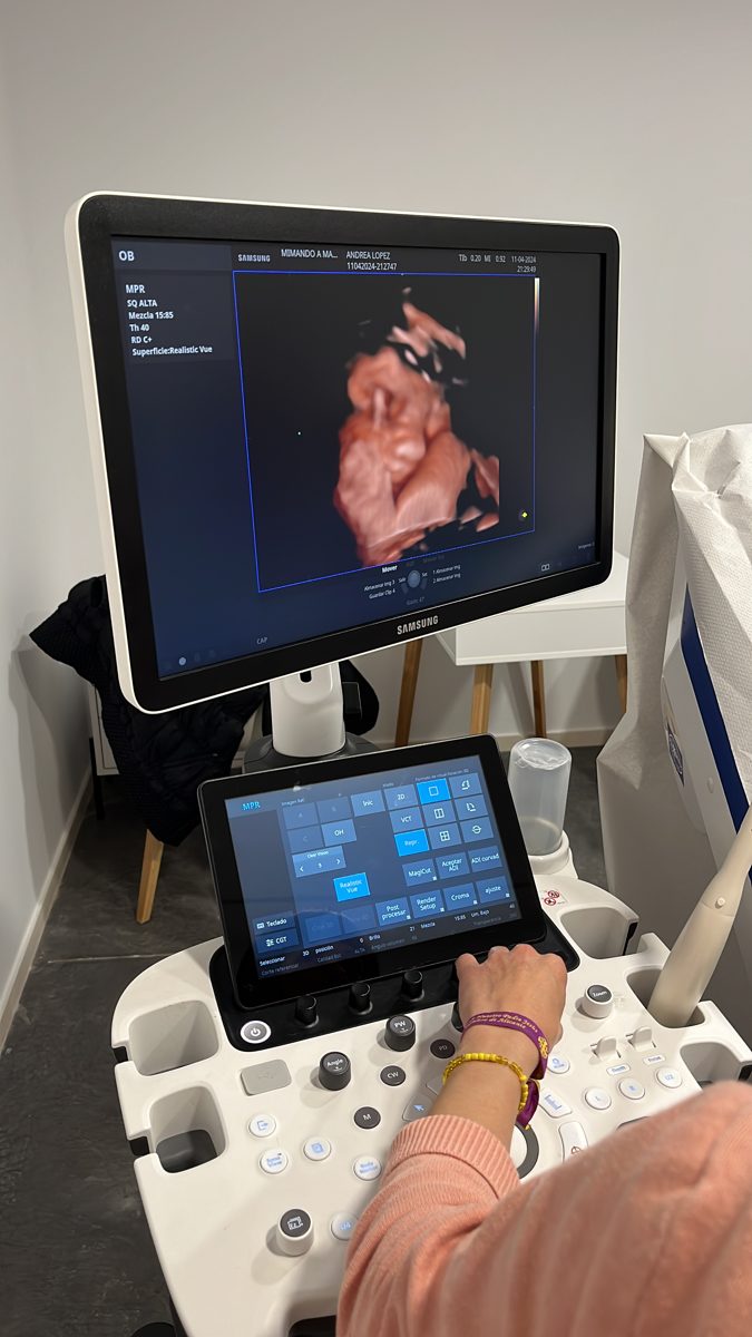 Ecógrafo de última generación en la consulta de ginecología de Mimando a Mamá, Alicante